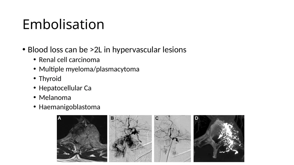 Preparation for spinal tumour - slide 6 of 19