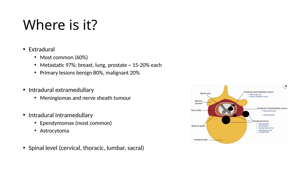 Preparation for spinal tumour - slide 2 of 19