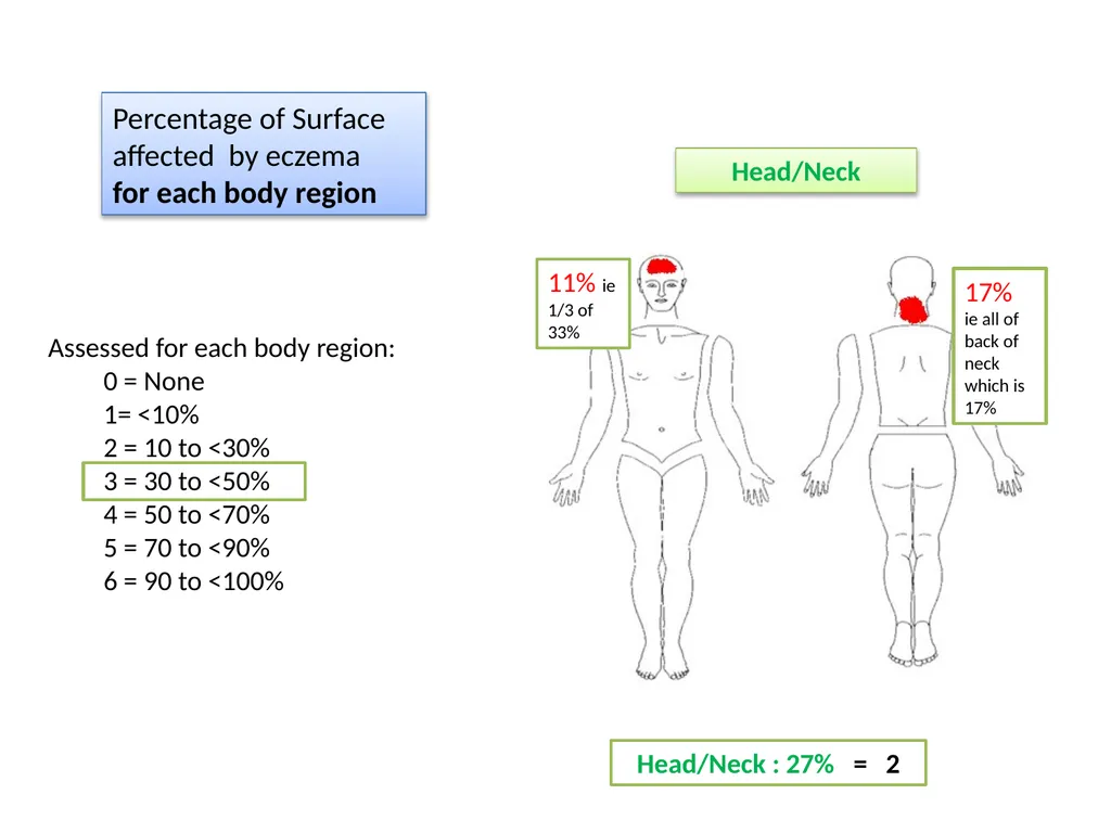 Introduction to assessing the severity of eczema - slide 33 of 40