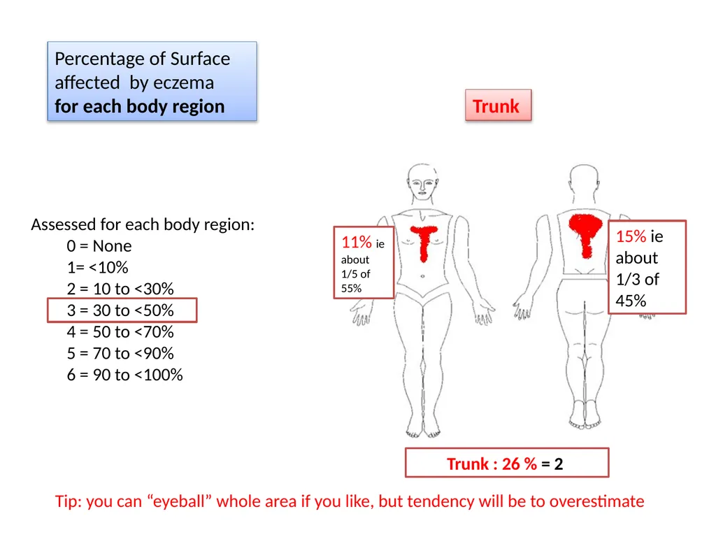 Introduction to assessing the severity of eczema - slide 35 of 40