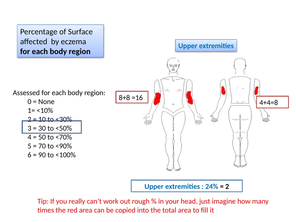 Introduction to assessing the severity of eczema - slide 38 of 40