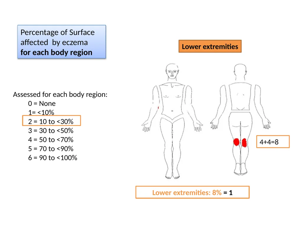 Introduction to assessing the severity of eczema - slide 40 of 40