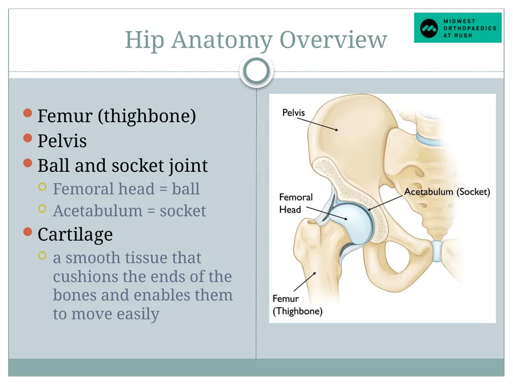 Welcome to Dr. Tad Gerlinger’s JOINT Replacement - slide 8 of 35