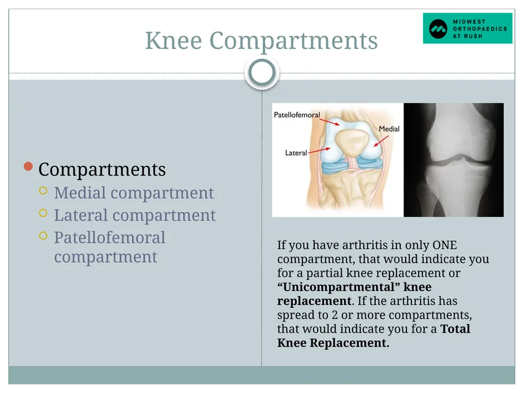 Welcome to Dr. Tad Gerlinger’s JOINT Replacement - slide 5 of 35