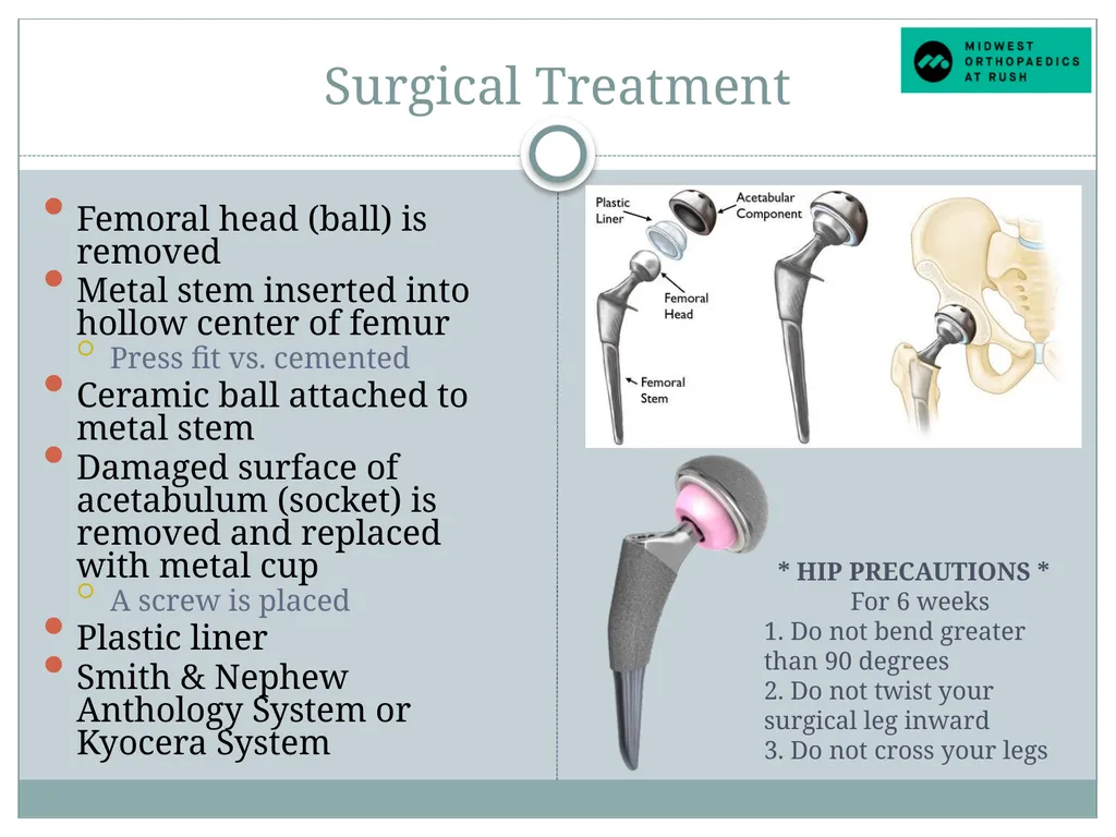 Welcome to Dr. Tad Gerlinger’s JOINT Replacement - slide 10 of 35