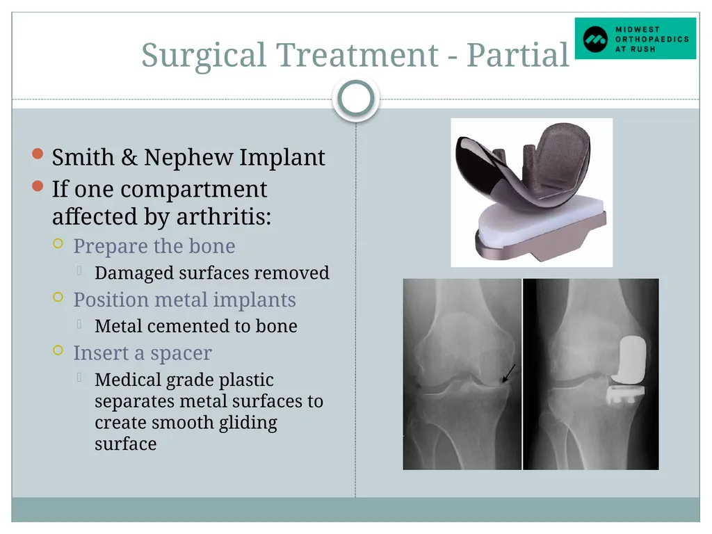 Welcome to Dr. Tad Gerlinger’s JOINT Replacement - slide 6 of 35