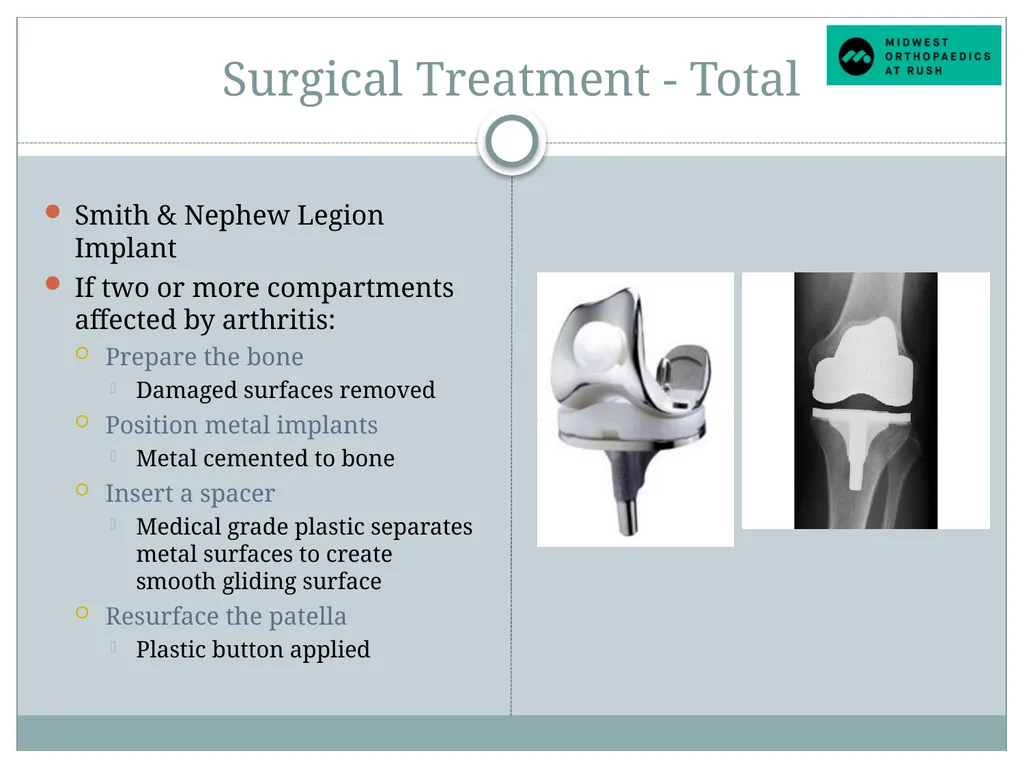 Welcome to Dr. Tad Gerlinger’s JOINT Replacement - slide 7 of 35