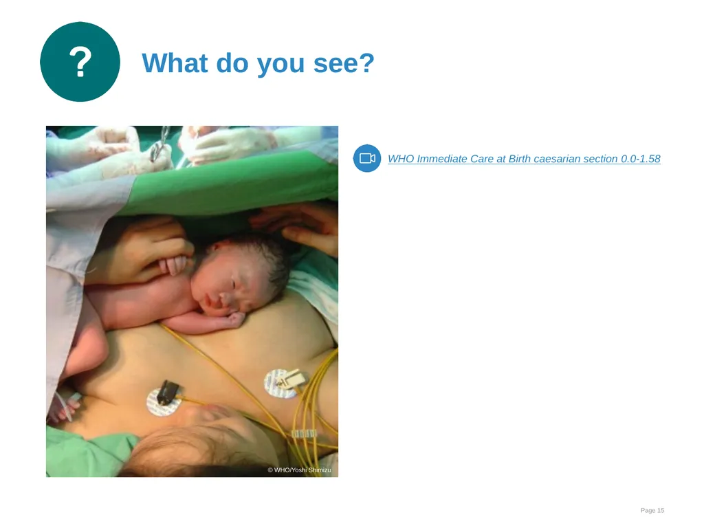 Immediate care at birth Goal and learning outcomes - slide 15 of 41
