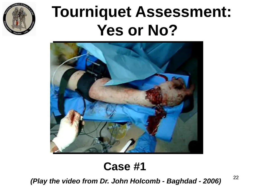 Who Does NOT Need a Tourniquet US/Ukraine - slide 22 of 54