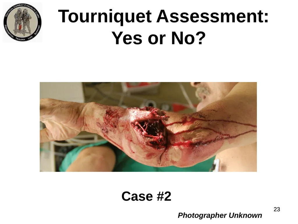 Who Does NOT Need a Tourniquet US/Ukraine - slide 23 of 54