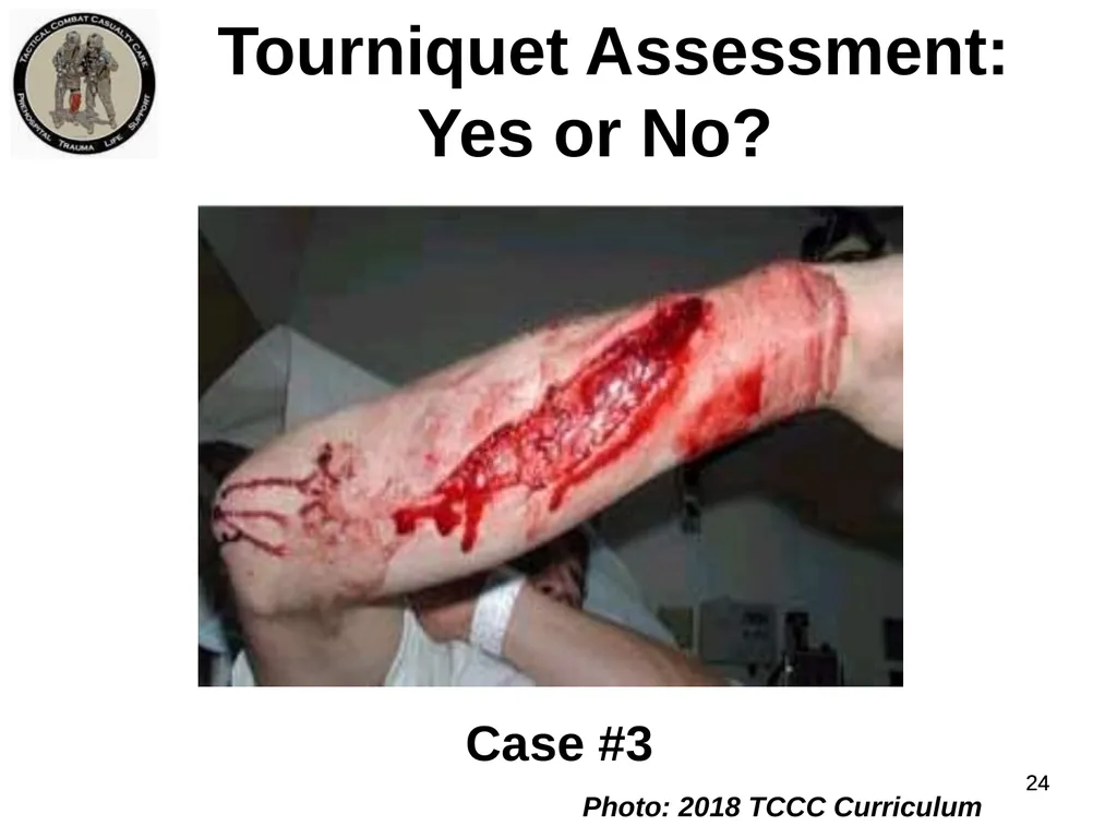 Who Does NOT Need a Tourniquet US/Ukraine - slide 24 of 54