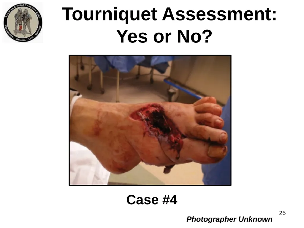 Who Does NOT Need a Tourniquet US/Ukraine - slide 25 of 54