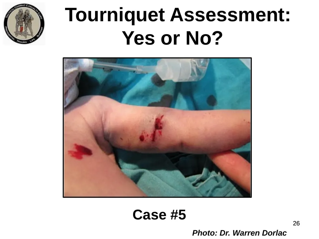Who Does NOT Need a Tourniquet US/Ukraine - slide 26 of 54