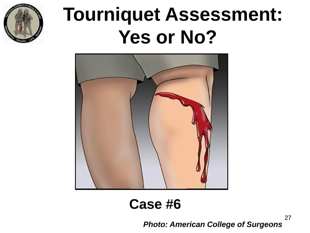 Who Does NOT Need a Tourniquet US/Ukraine - slide 27 of 54