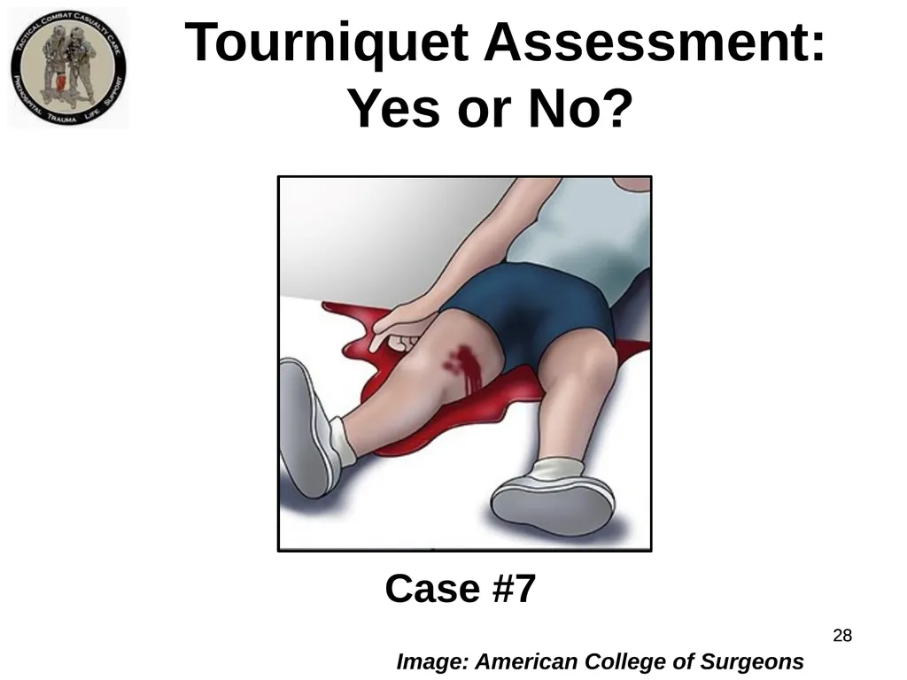 Who Does NOT Need a Tourniquet US/Ukraine - slide 28 of 54