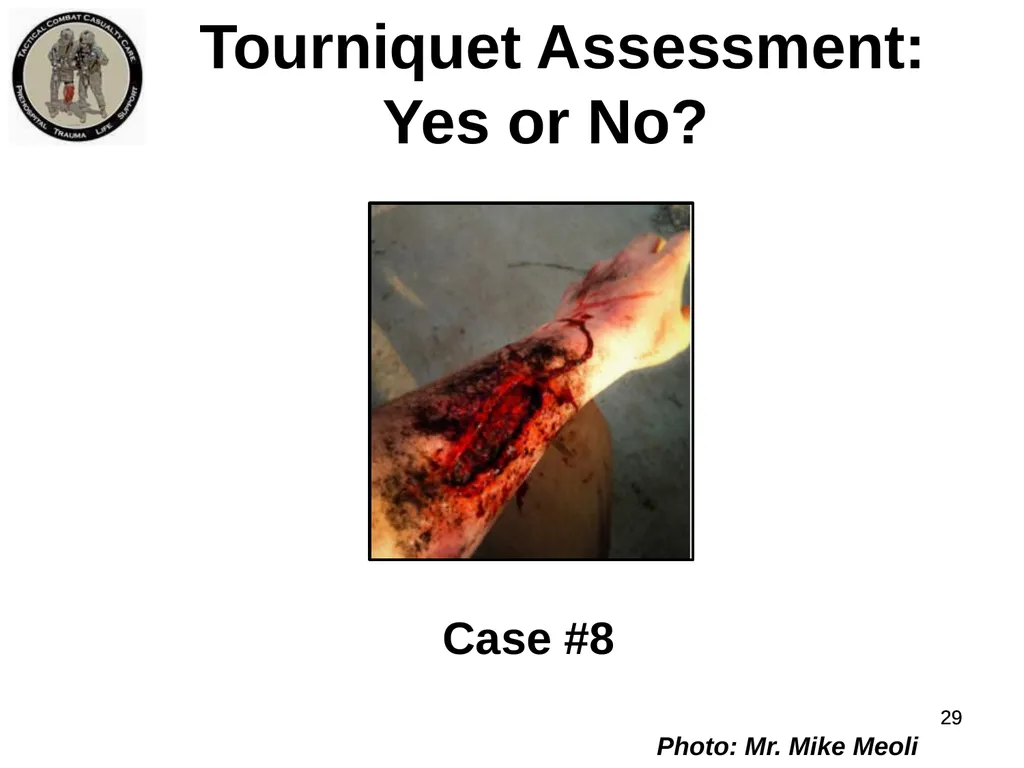 Who Does NOT Need a Tourniquet US/Ukraine - slide 29 of 54