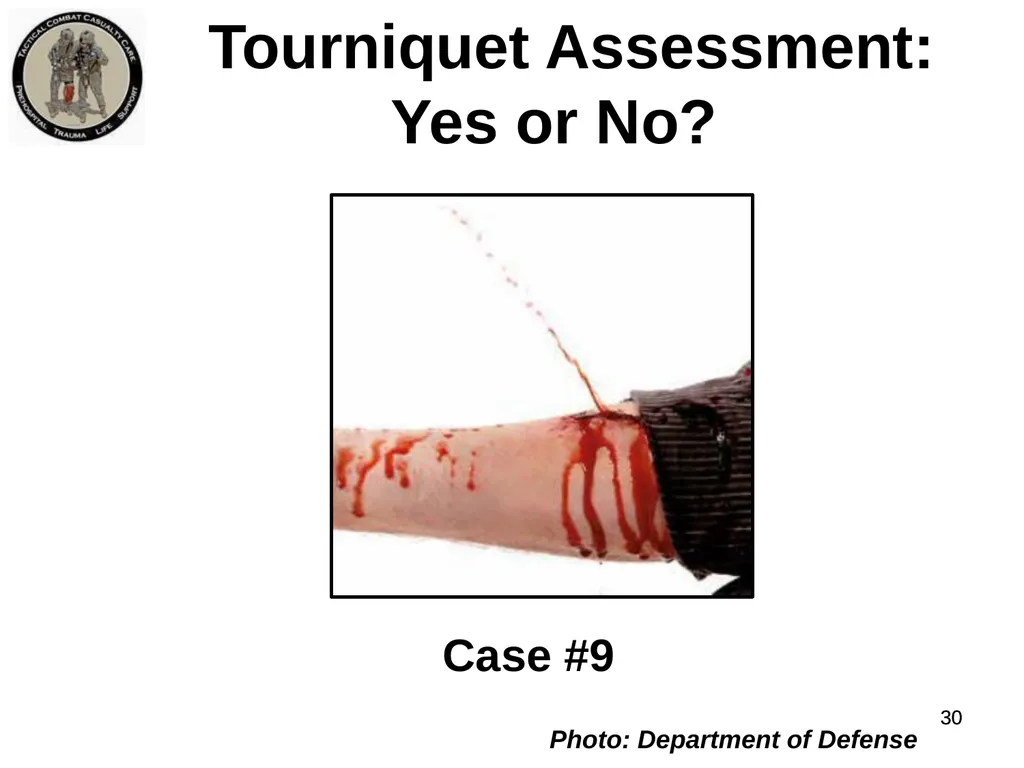 Who Does NOT Need a Tourniquet US/Ukraine - slide 30 of 54