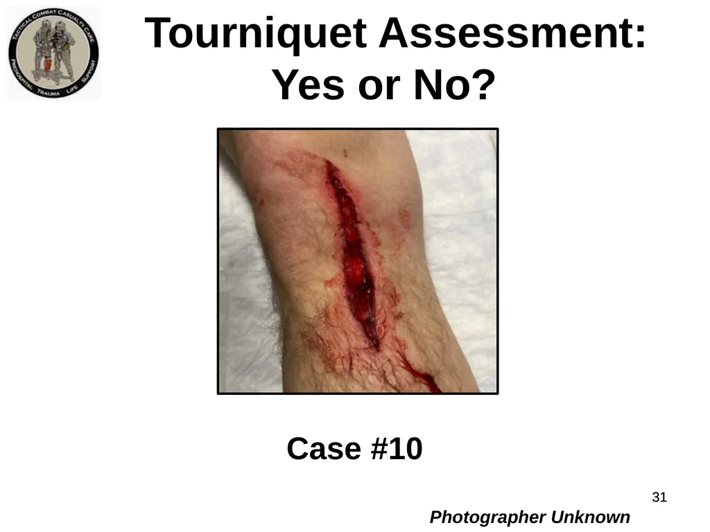 Who Does NOT Need a Tourniquet US/Ukraine - slide 31 of 54