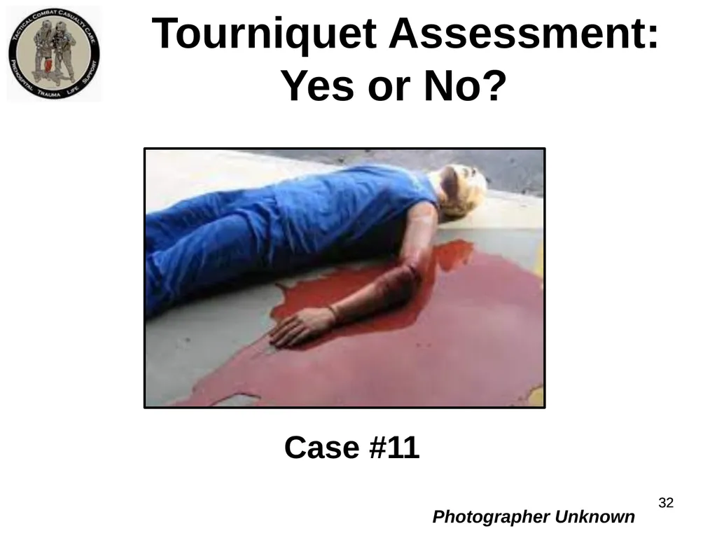 Who Does NOT Need a Tourniquet US/Ukraine - slide 32 of 54