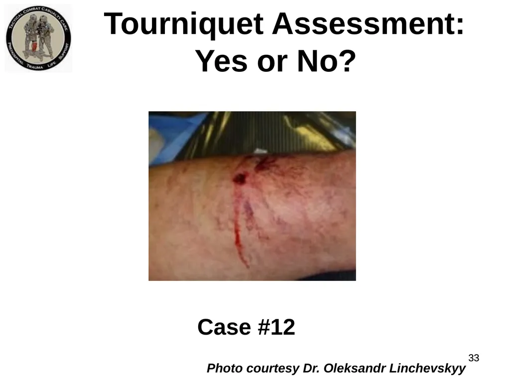 Who Does NOT Need a Tourniquet US/Ukraine - slide 33 of 54