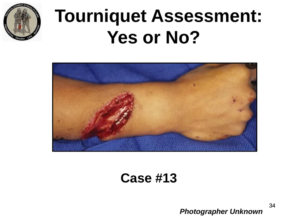 Who Does NOT Need a Tourniquet US/Ukraine - slide 34 of 54