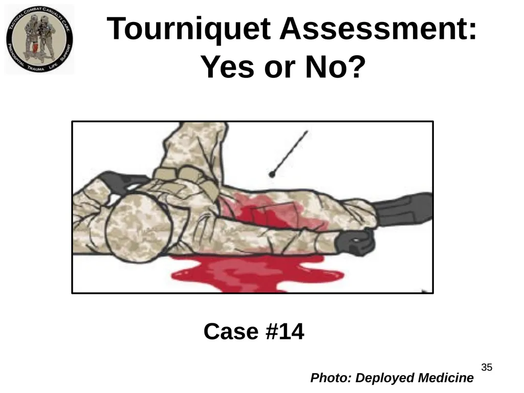 Who Does NOT Need a Tourniquet US/Ukraine - slide 35 of 54