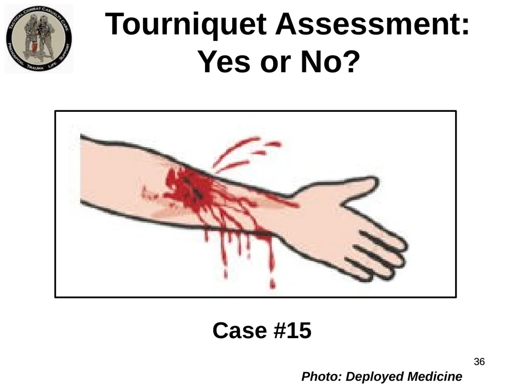 Who Does NOT Need a Tourniquet US/Ukraine - slide 36 of 54