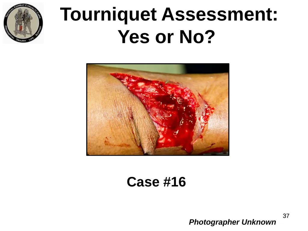 Who Does NOT Need a Tourniquet US/Ukraine - slide 37 of 54