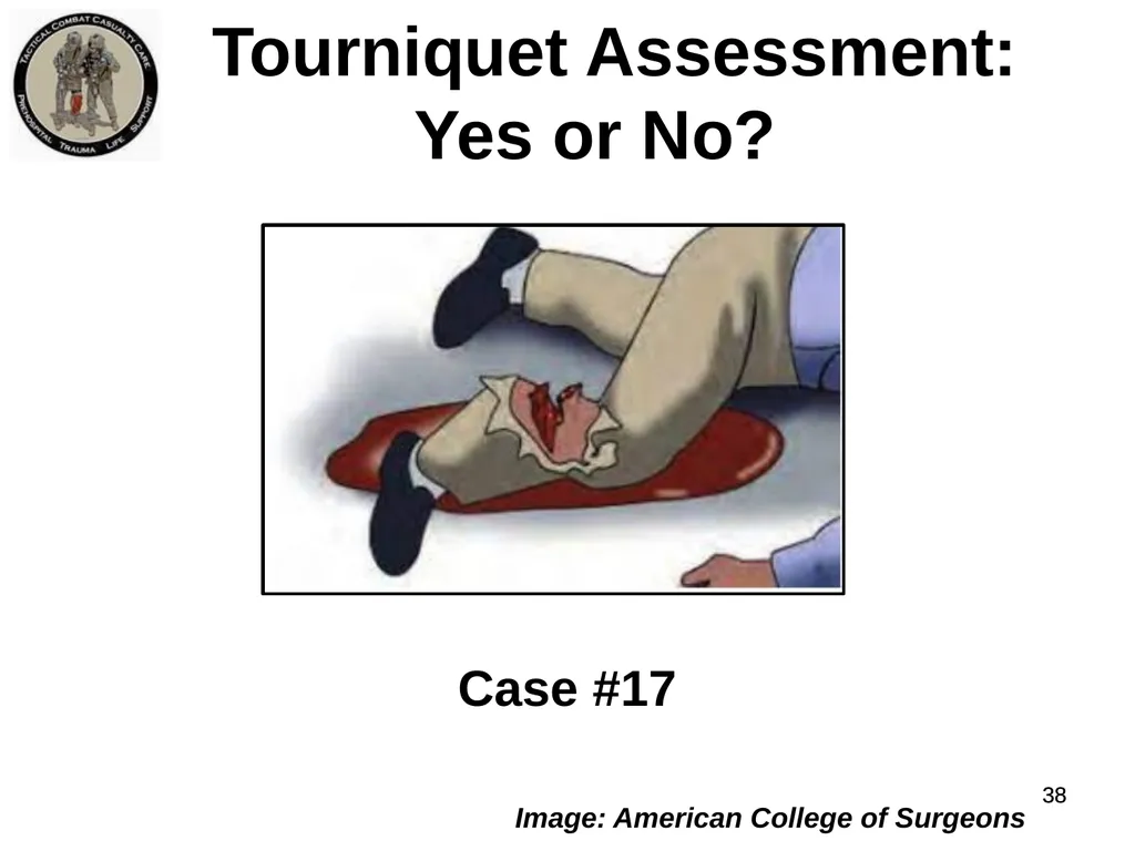 Who Does NOT Need a Tourniquet US/Ukraine - slide 38 of 54