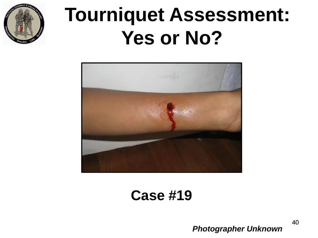 Who Does NOT Need a Tourniquet US/Ukraine - slide 40 of 54