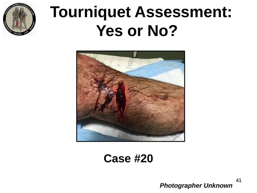 Who Does NOT Need a Tourniquet US/Ukraine - slide 41 of 54