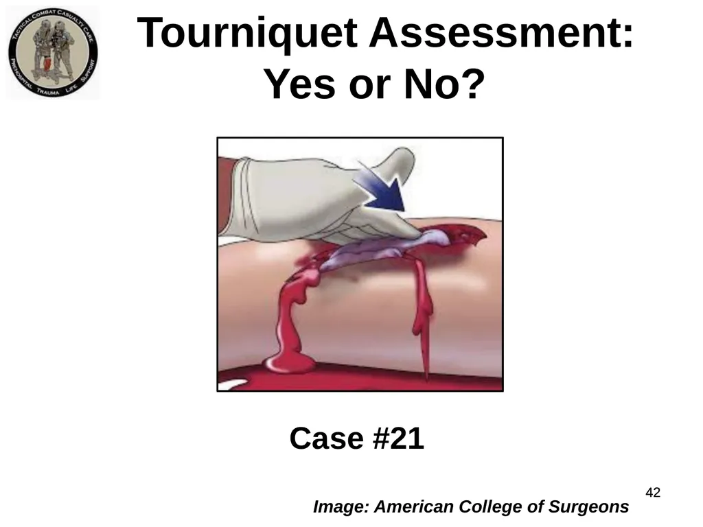 Who Does NOT Need a Tourniquet US/Ukraine - slide 42 of 54