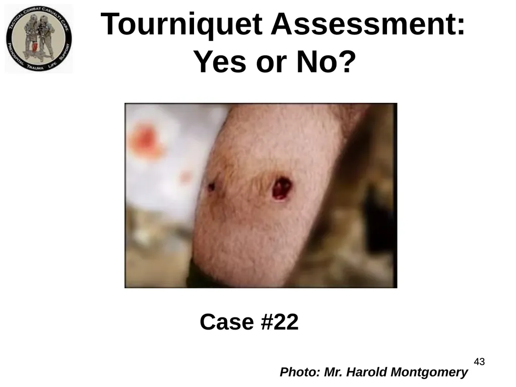 Who Does NOT Need a Tourniquet US/Ukraine - slide 43 of 54