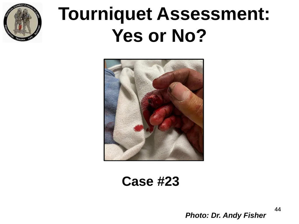 Who Does NOT Need a Tourniquet US/Ukraine - slide 44 of 54
