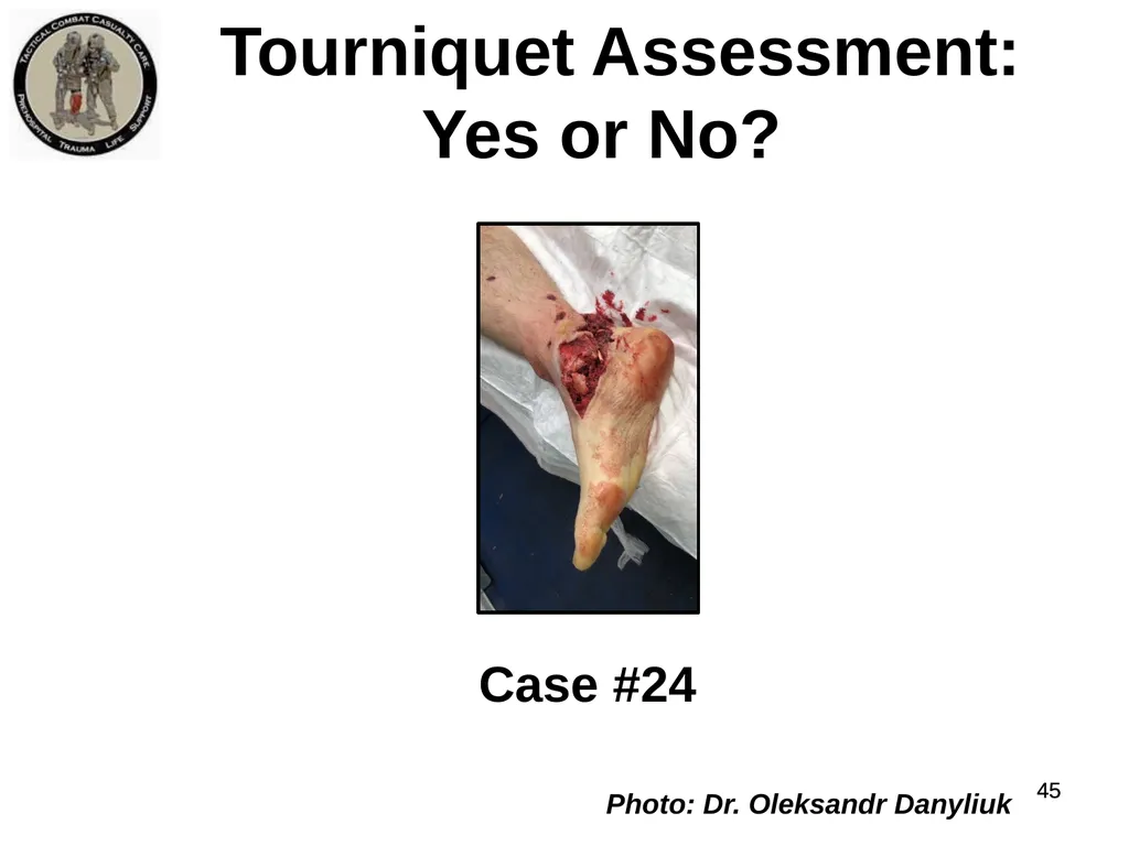 Who Does NOT Need a Tourniquet US/Ukraine - slide 45 of 54