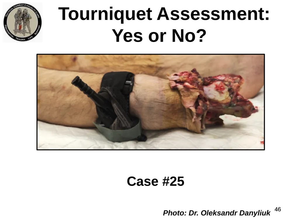 Who Does NOT Need a Tourniquet US/Ukraine - slide 46 of 54