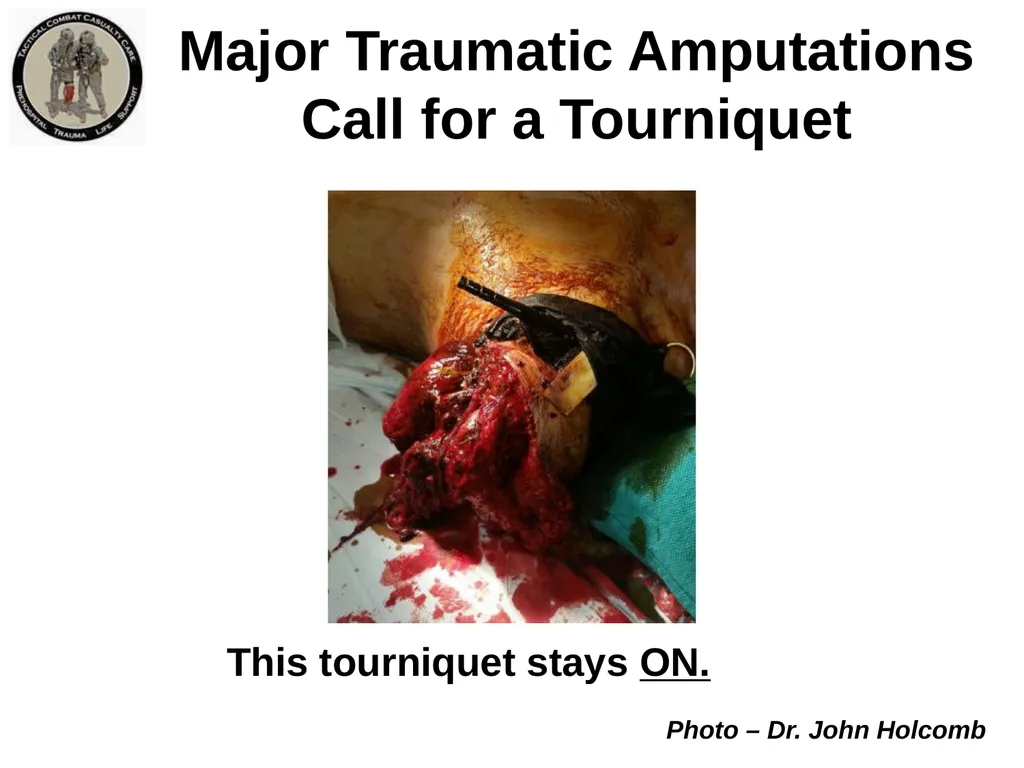 Who Does NOT Need a Tourniquet US/Ukraine - slide 21 of 54