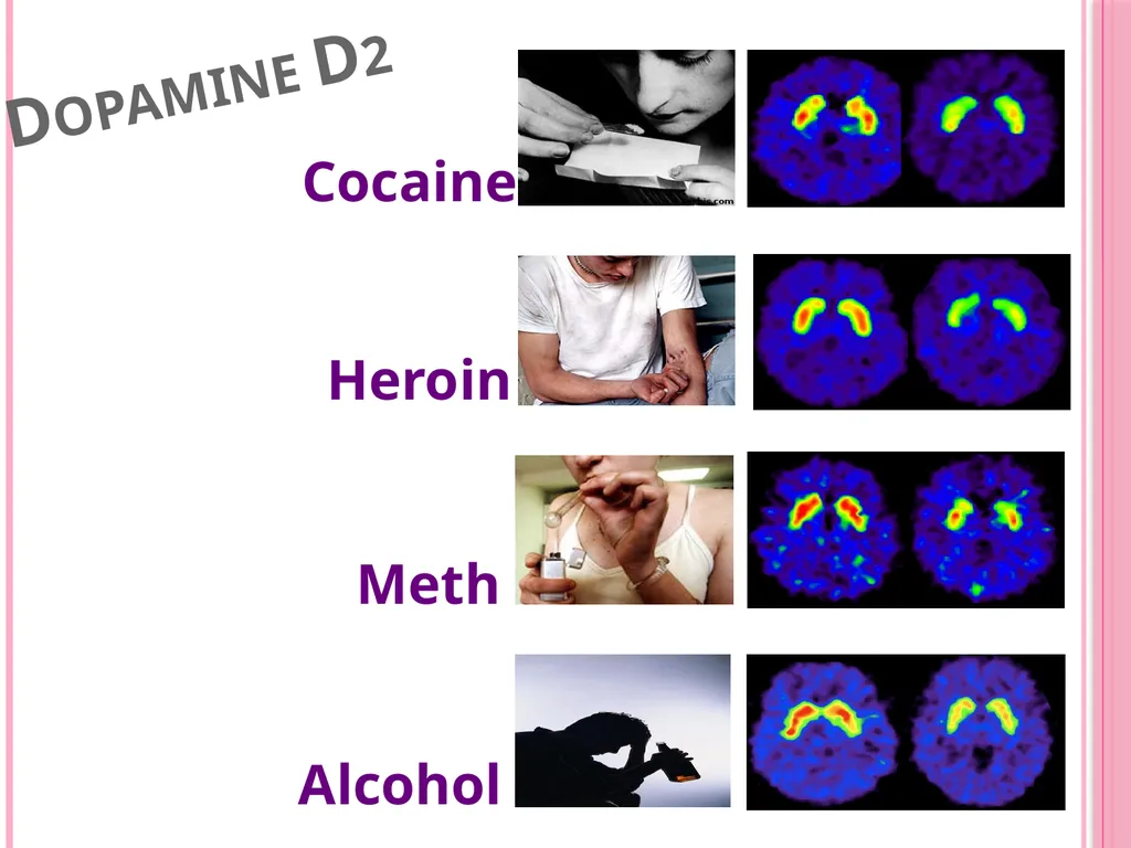 Sugar: Is it really that Sweet? Does sugar cause - slide 5 of 21