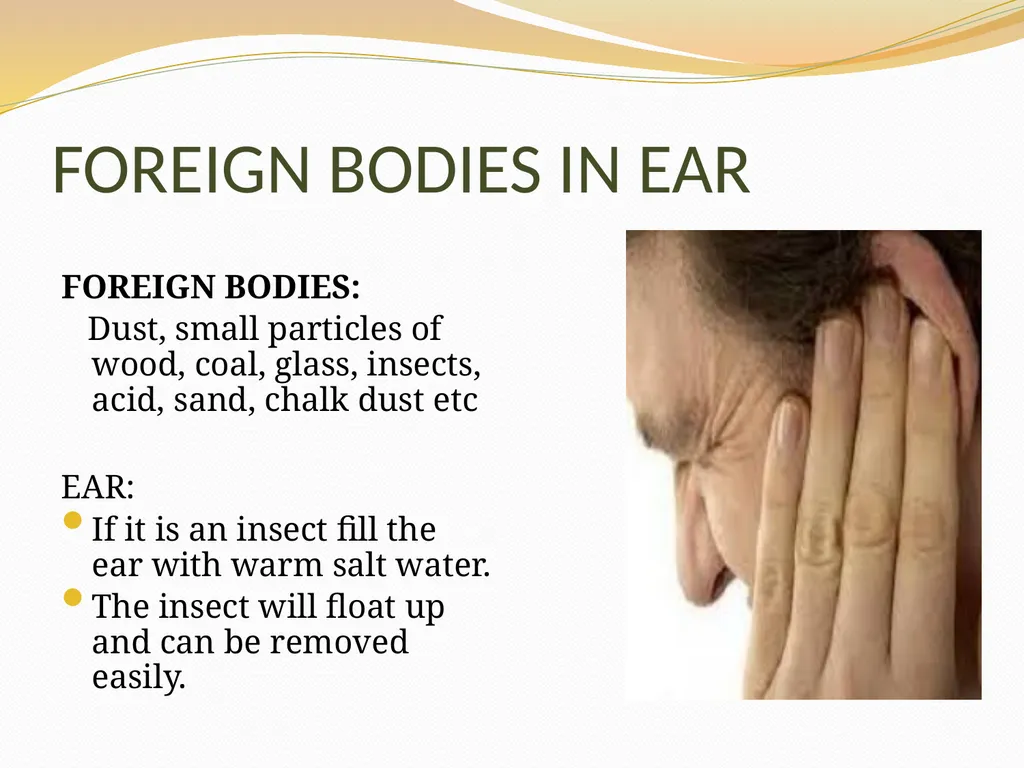 BASIC FIRST AID Submitted by, Department of - slide 45 of 55