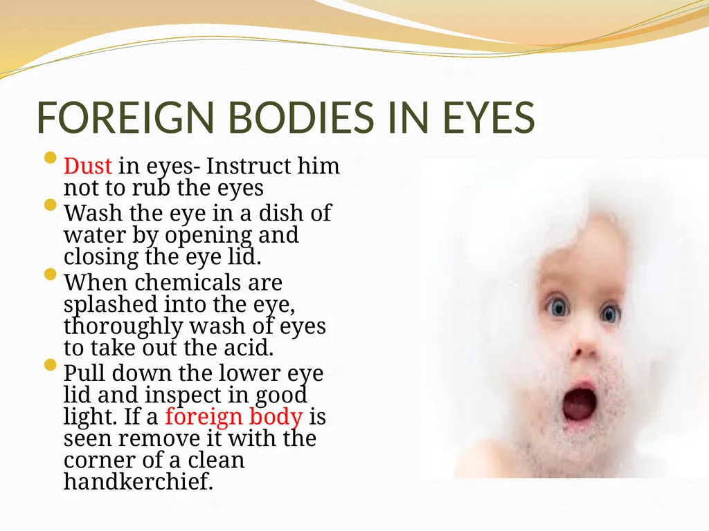 BASIC FIRST AID Submitted by, Department of - slide 46 of 55