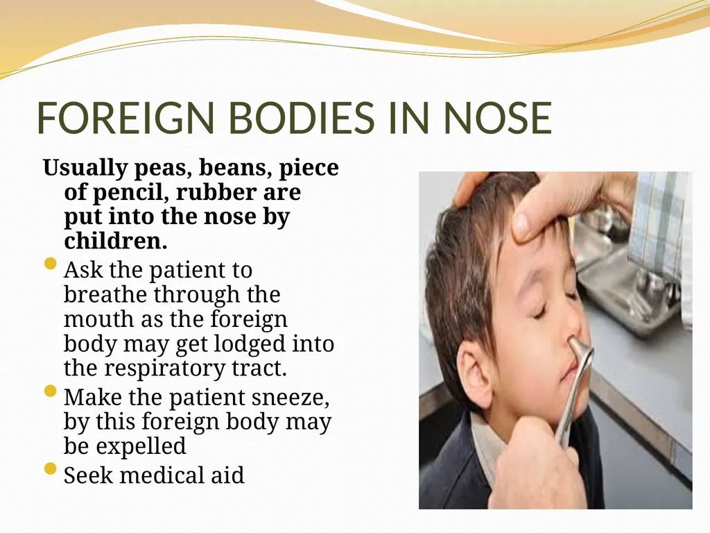 BASIC FIRST AID Submitted by, Department of - slide 47 of 55