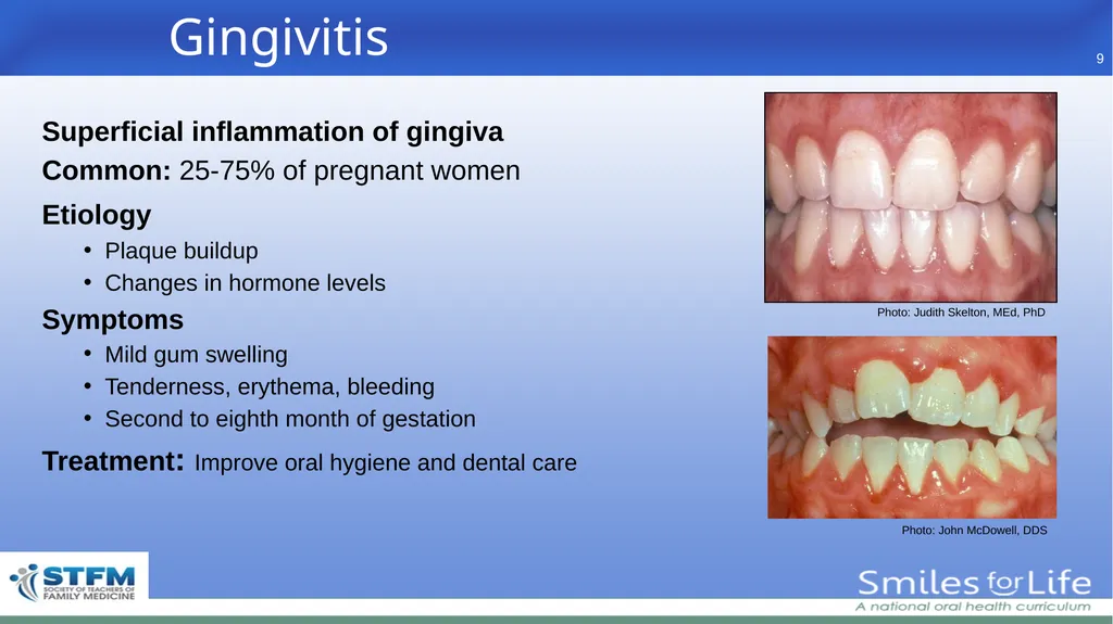 Fourth Edition 2020 - slide 9 of 46