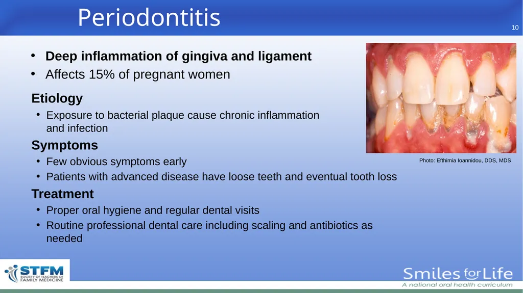 Fourth Edition 2020 - slide 10 of 46