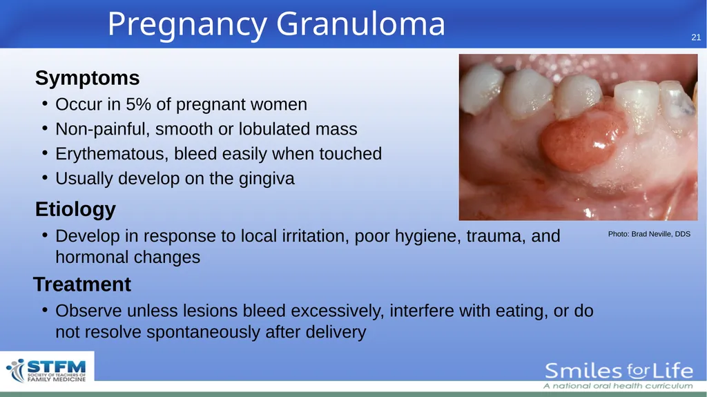 Fourth Edition 2020 - slide 21 of 46