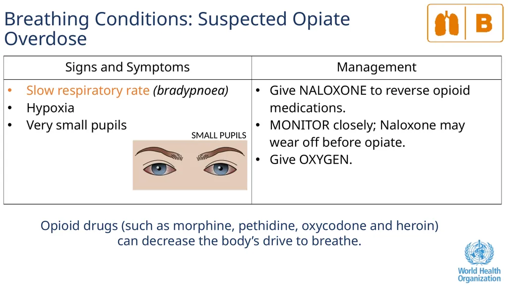 The ABCDE and SAMPLE History Approach Basic - slide 37 of 69