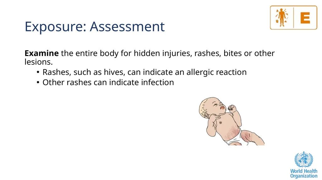 The ABCDE and SAMPLE History Approach Basic - slide 27 of 69