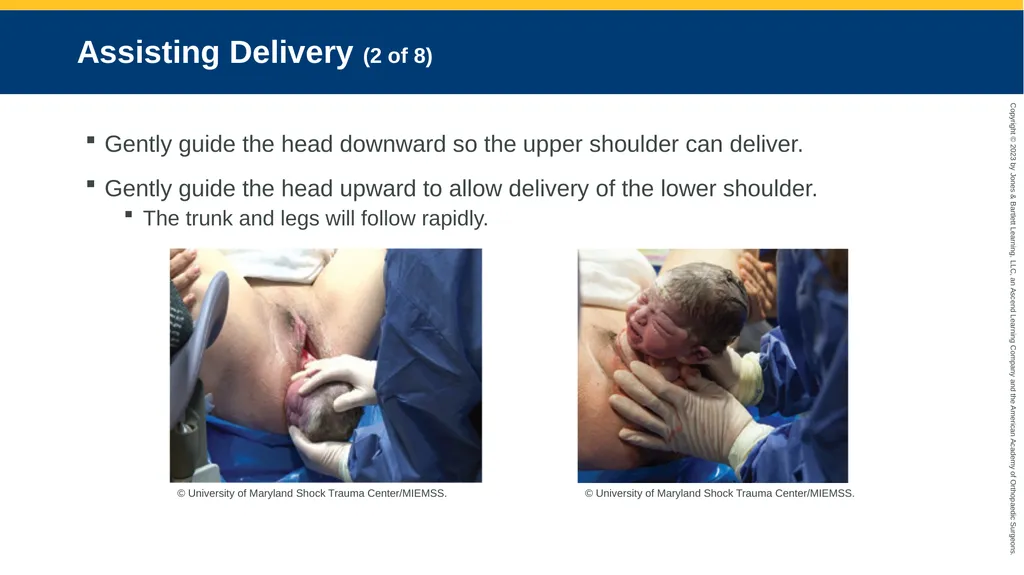 Obstetrics CHAPTER 42 Introduction Pregnancy is - slide 113 of 182