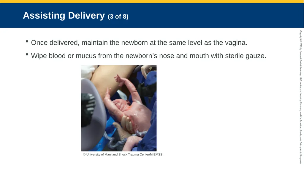 Obstetrics CHAPTER 42 Introduction Pregnancy is - slide 114 of 182