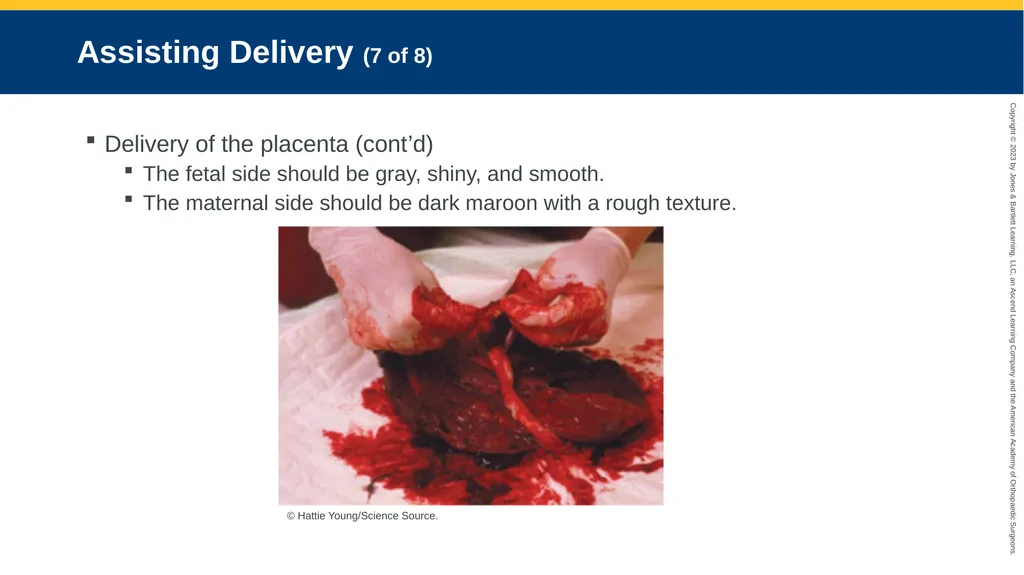 Obstetrics CHAPTER 42 Introduction Pregnancy is - slide 118 of 182