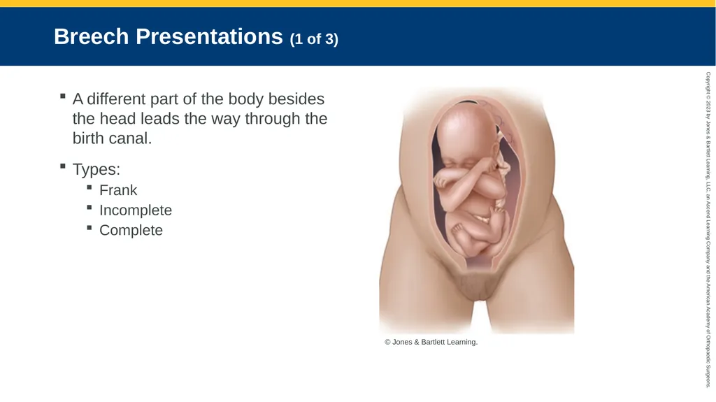 Obstetrics CHAPTER 42 Introduction Pregnancy is - slide 151 of 182